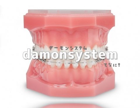 歯列矯正＊デーモンシステムの費用と期間